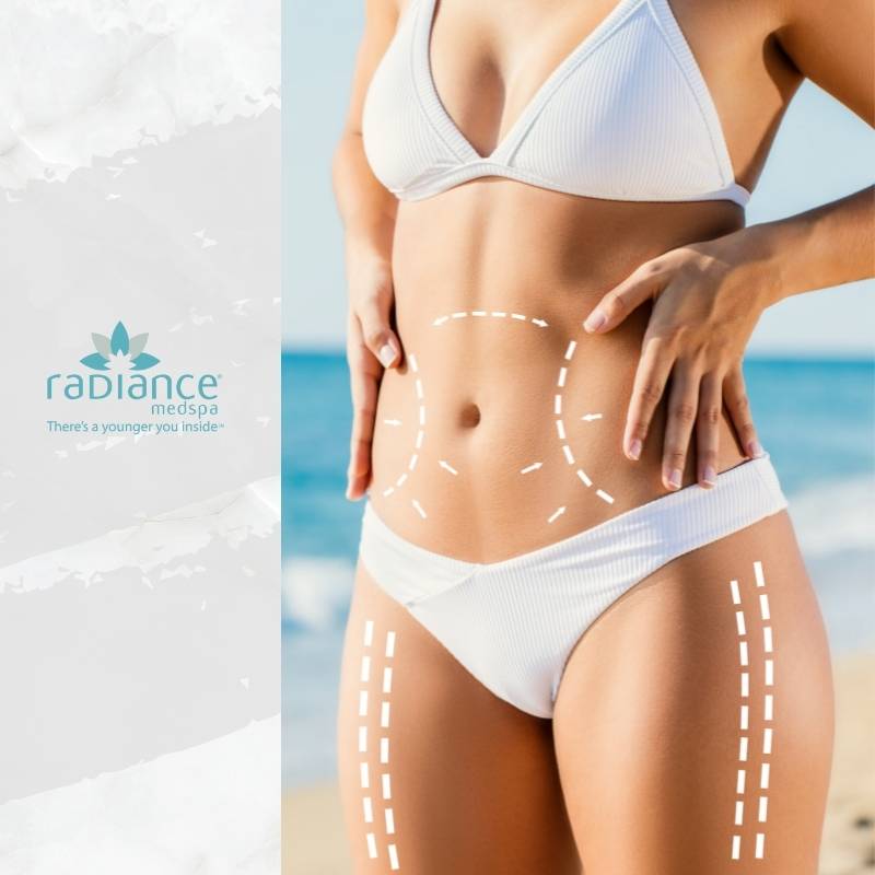 Get Ready for Summer with SculpSure, our New Body Contouring Treatment -  Abbracci Med Spa